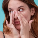 skin purging